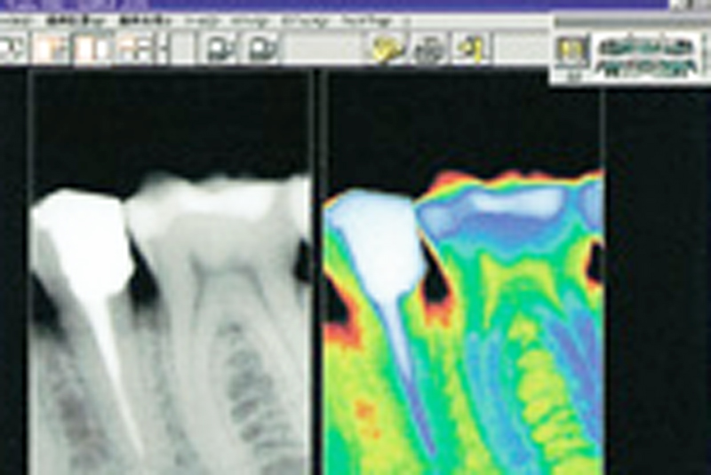 デジタル画像処理システム